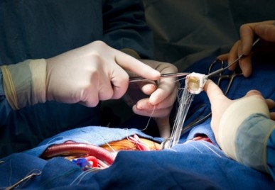 CTVS - ARHI Hospital