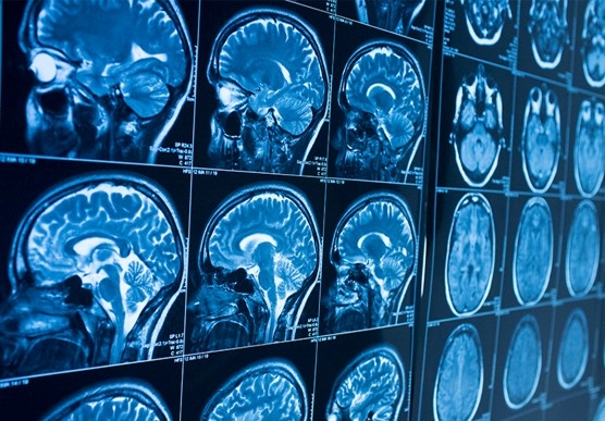 Radiology - ARHI Hospital