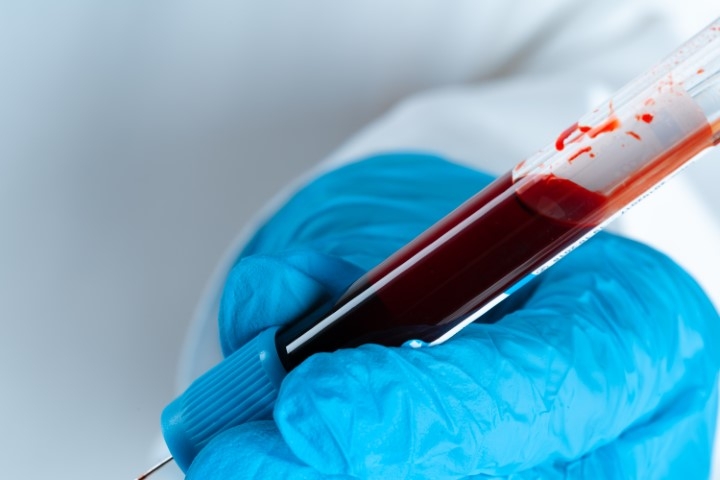 Blood Bank - ARHI Hospital